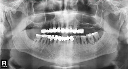 miért fáj a fogaim a fogaim mely gyógymódok jobbak a dohányzásról való leszokásban