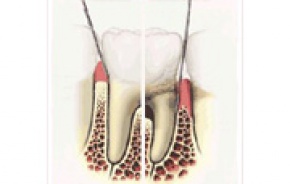 Parodontol gia fog gy fog ny Fog szati rak Tour de Dental