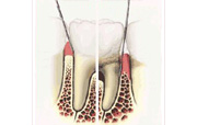 Parodontológia (fogágy, fogíny)
