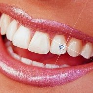 Tooth jewel