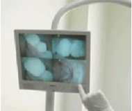 Radiografia completa digitale